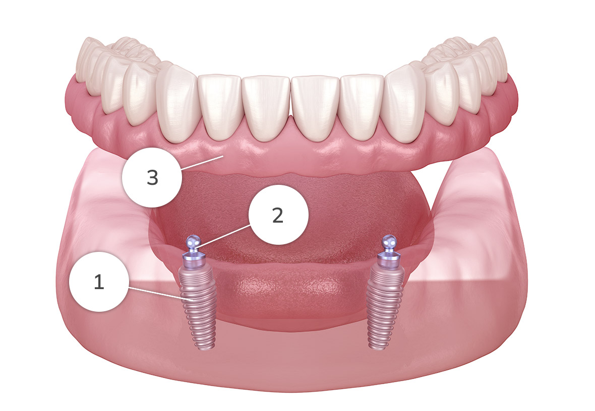 Supported Diagram